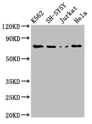 PRKCB / PKC-Beta Antibody