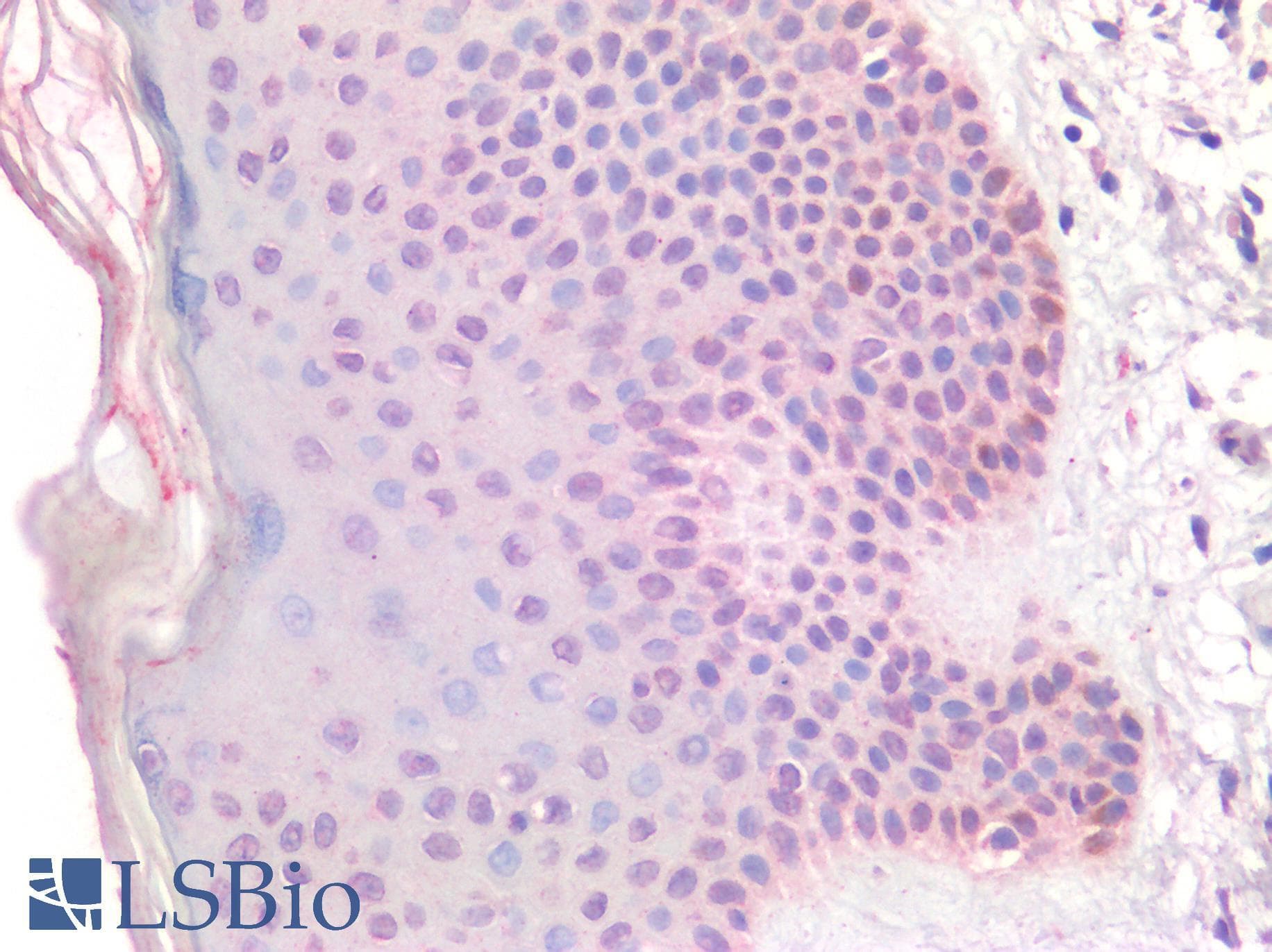 IHC-plus™ DLX2 Antibody