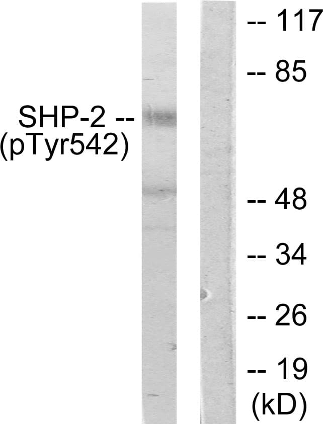 Polyclonal Rabbit anti-Human PTPN11 / SHP-2 / NS1 Antibody (phospho-Tyr542, IHC, WB)