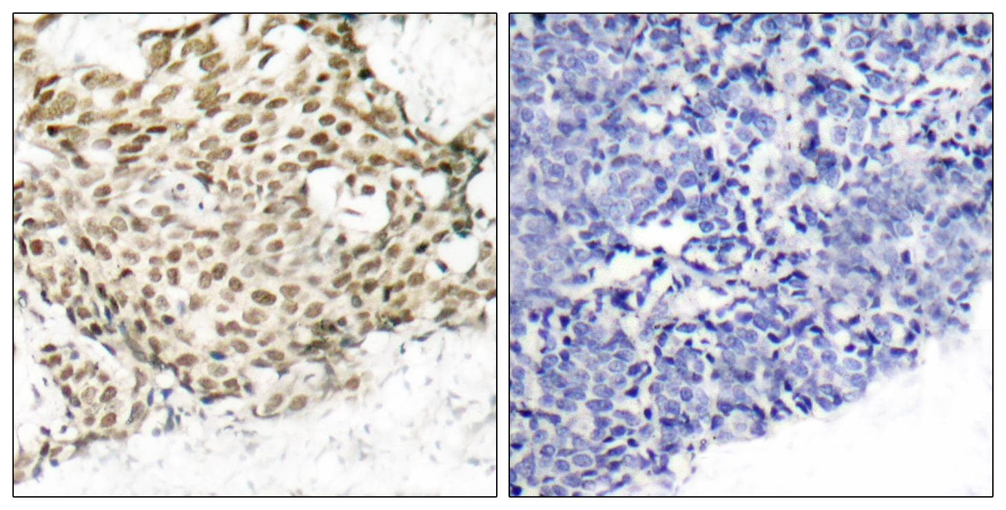 NBN / Nibrin Antibody (p343)