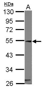 CASQ1 / Calsequestrin 1 Antibody