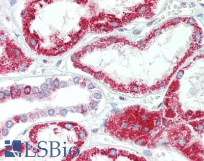 IHC-plus™ HSD17B8 / RING2 Antibody