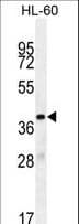 Polyclonal Rabbit anti-Human OR10J5 Antibody (aa243-270, WB)