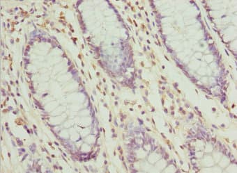 Polyclonal Rabbit anti-Human ZFAND3 / TEX27 Antibody (IHC)