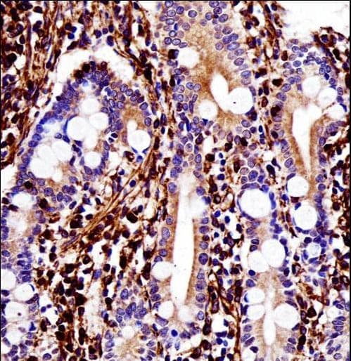 IHC-plus™ Polyclonal Rabbit anti-Human Vimentin Antibody (IHC, IF, WB)