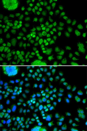Polyclonal Rabbit anti-Human ATOH7 / MATH5 Antibody (IHC, IF, WB)