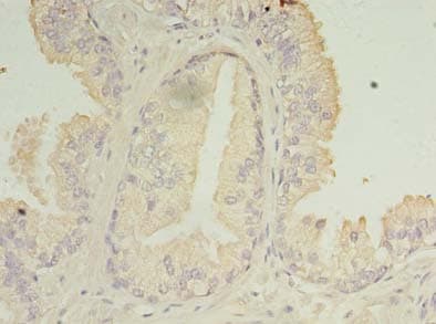 Polyclonal Rabbit anti-Human C11orf45 Antibody (IHC)