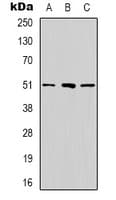 Polyclonal Rabbit anti-Human RRP8 Antibody (Internal, IHC, WB)