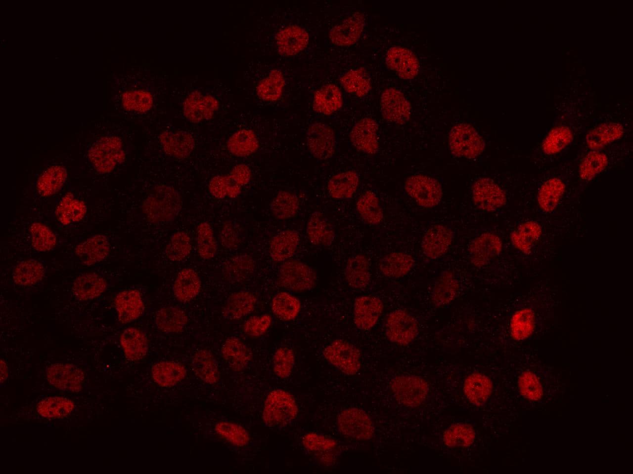 Polyclonal Rabbit anti-Human PYGO2 / Pygopus 2 Antibody (Preservative Free, IF, WB)
