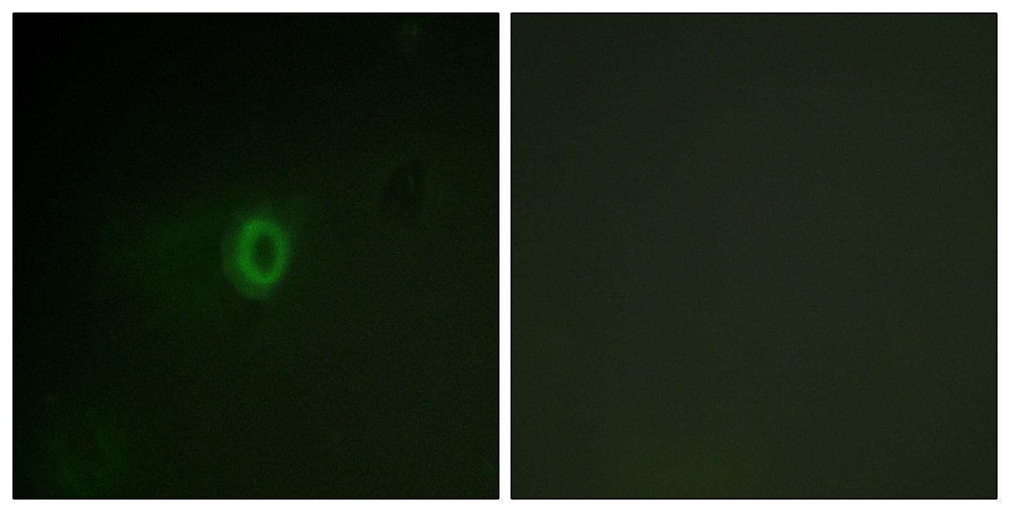 PIK3R1 / p85 Alpha Antibody (phospho-Tyr467/199)