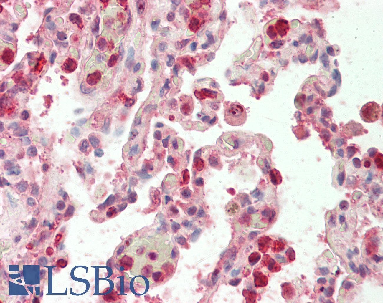 Polyclonal Rabbit anti-Human H2AFY / MACROH2A1 Antibody (aa144-193, IHC, WB)