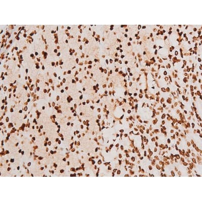 Polyclonal Rabbit anti-Human SYK Antibody (phospho-Tyr348, IHC, IF, WB)