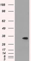 SRR / Serine Racemase Antibody (clone OTI1D7)