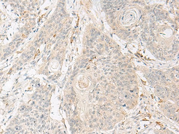 GNAT3 / Gustducin Antibody
