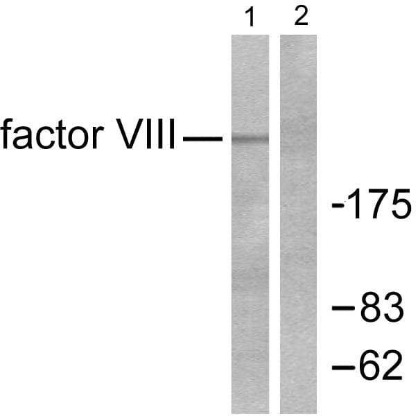 F8 / FVIII / Factor VIII Antibody