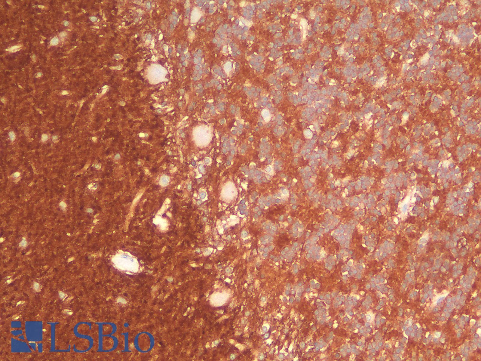 PathPlus™ Recombinant Monoclonal Rabbit anti-Human NCAM / CD56 Antibody (clone NCAM1/2217R, IHC)