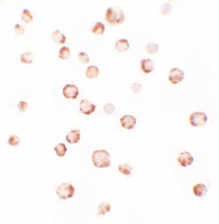 IHC-plus™ PHLPP2 / PHLPPL Antibody