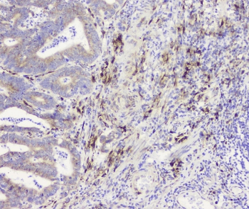 Polyclonal Rabbit anti-Human RRBP1 / hES Antibody (IHC, WB)