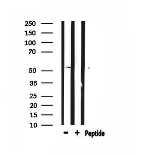 HTR2B / 5-HT2B Receptor Antibody