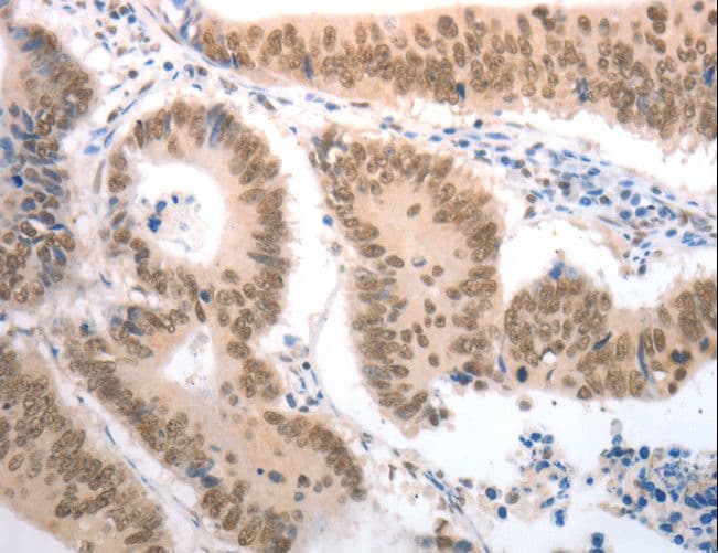 RAD52 Antibody