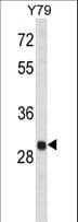 MAPK1IP1L Antibody (aa108-137)