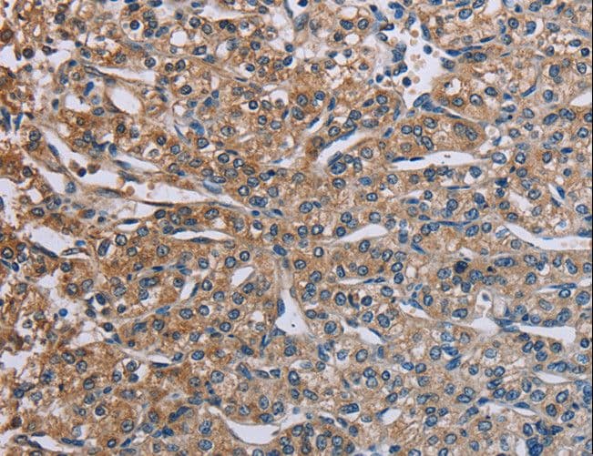 PLXND1 / Plexin D1 Antibody