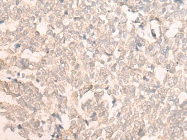 FAN1 Antibody