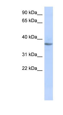 Polyclonal Rabbit anti-Human OR10X1 Antibody (aa383-432, WB)