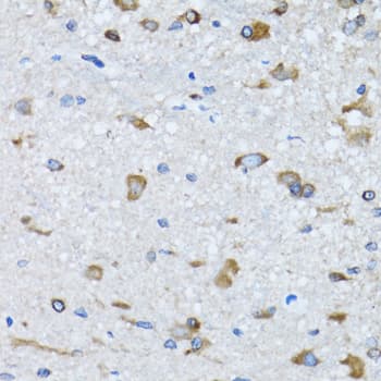 Polyclonal Rabbit anti-Human RARS Antibody (IHC, IF, WB)