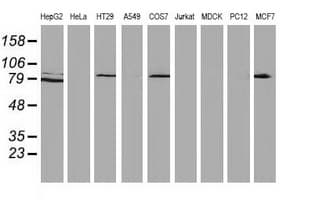 CTNNB1 / Beta Catenin Antibody (clone OTI5D2)