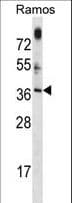 MTG1 / Mitochondrial GTPase 1 Antibody (aa116-143)