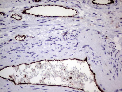 PECAM-1 / CD31 Antibody (clone UMAB164)
