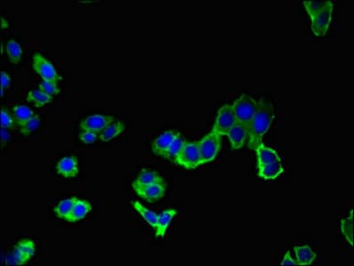 Polyclonal Rabbit anti-Human AAK1 Antibody (IHC, IF, WB)