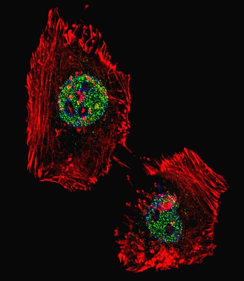 Polyclonal Rabbit anti-Human KDM1A / LSD1 Antibody (aa819-852, IHC, IF, WB)