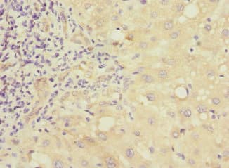 MMP19 Antibody