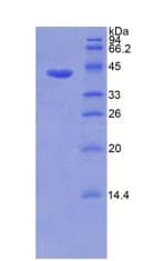Human MMP8 Protein (Recombinant His)
