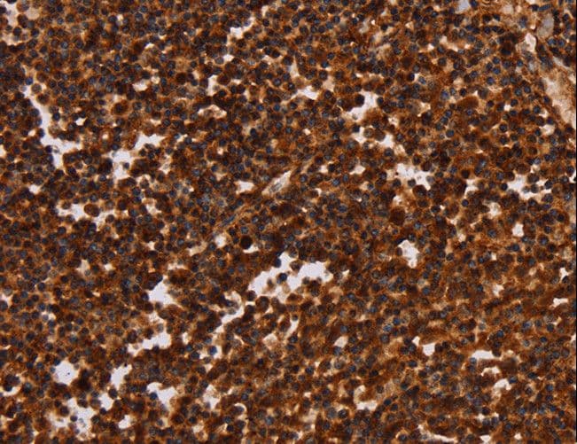 ALG11 Antibody