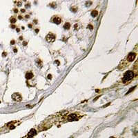SSX2 Antibody