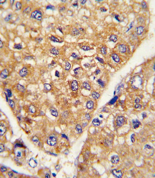 Polyclonal Rabbit anti-Human LRRC32 Antibody (aa234-260, IHC, WB)