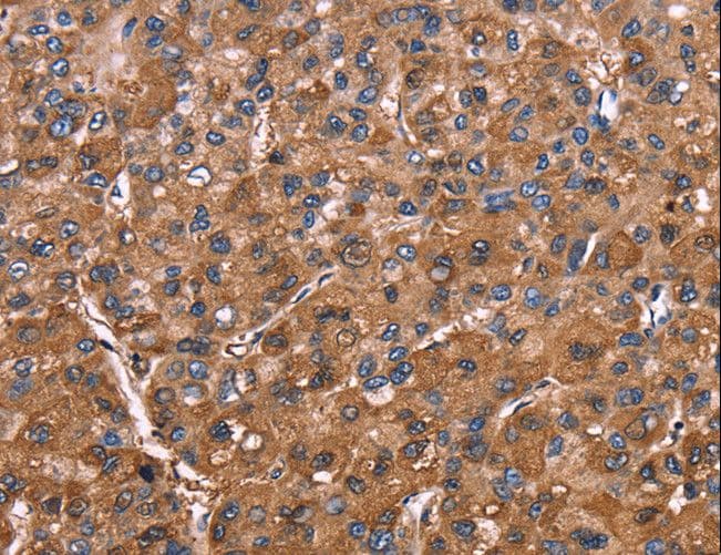 ELP2 / STATIP1 Antibody