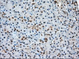 Monoclonal Mouse anti-Human PFN1 / Profilin 1 Antibody (clone OTI1D5, IHC, IF, WB)