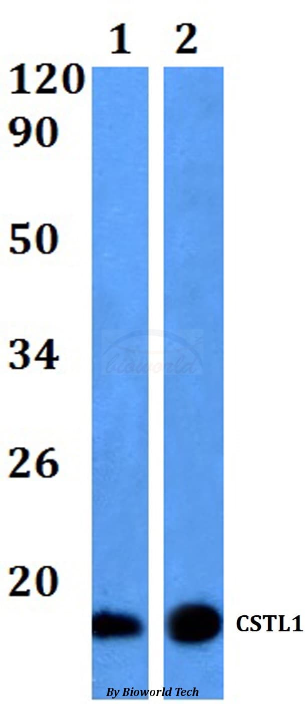 Polyclonal Rabbit anti-Human CSTL1 / Cystatin-Like 1 Antibody (WB)