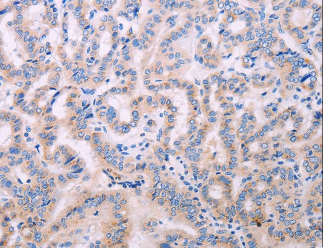 ADCY5 / Adenylate Cyclase 5 Antibody