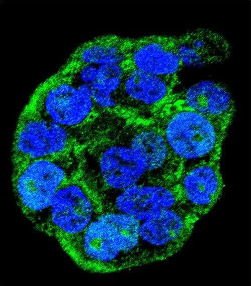 IHC-plus™ Polyclonal Rabbit anti-Human WTIP Antibody (aa243-271, IHC, IF, WB)