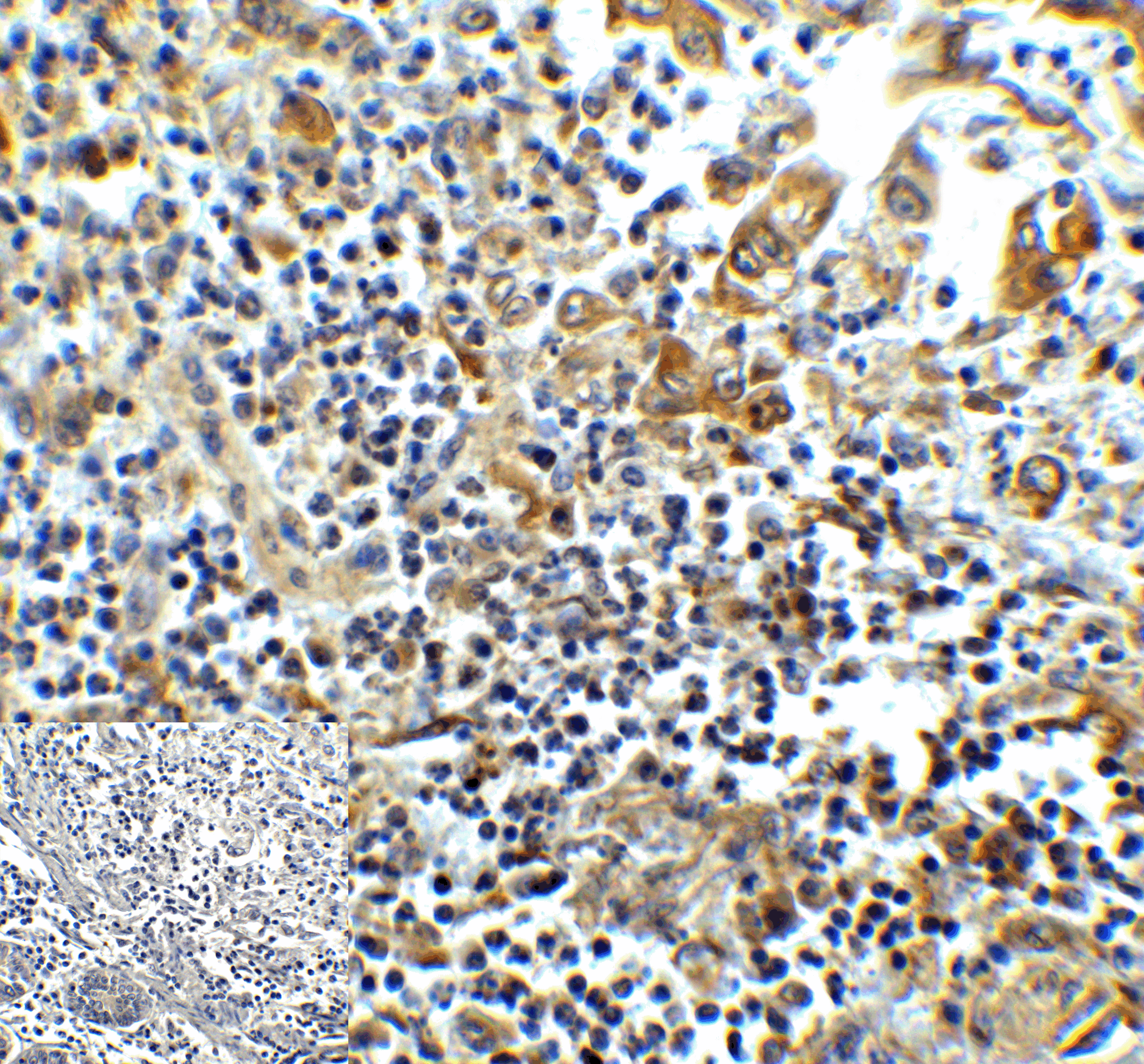 Monoclonal Mouse anti-Human HAVCR2 / TIM-3 Antibody (clone 1C6, IHC, IF)