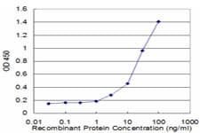 KRT8 / CK8 / Cytokeratin 8 Antibody (clone 3E3)