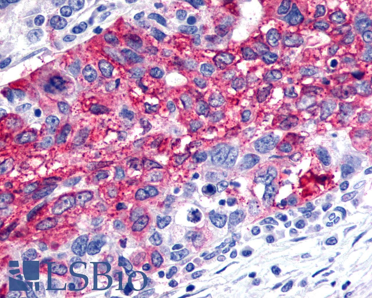 IHC-plus™ FZD2 / Frizzled 2 Antibody (Extracellular Domain)