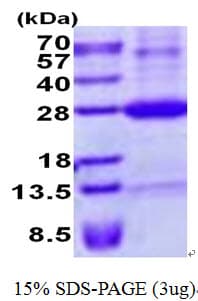 Human NKG2DL4 / ULBP4 Protein (Recombinant His)