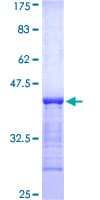 Human USP6 / HRP1 Protein (Recombinant GST, N-terminus)