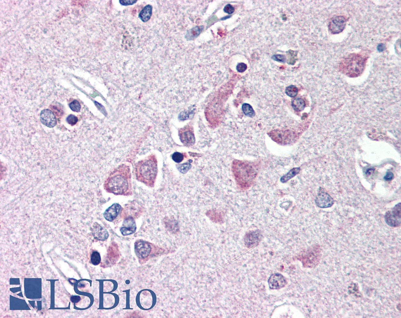 IHC-plus™ Polyclonal Rabbit anti-Human FEM1B Antibody (IHC, IF, WB)